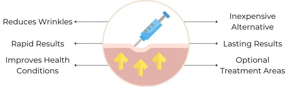 Botox in Clapham benefits diagram showing its advantages: Reduces wrinkles, rapid results, improved health conditions, inexpensive alternative, lasting results, optional treatment.