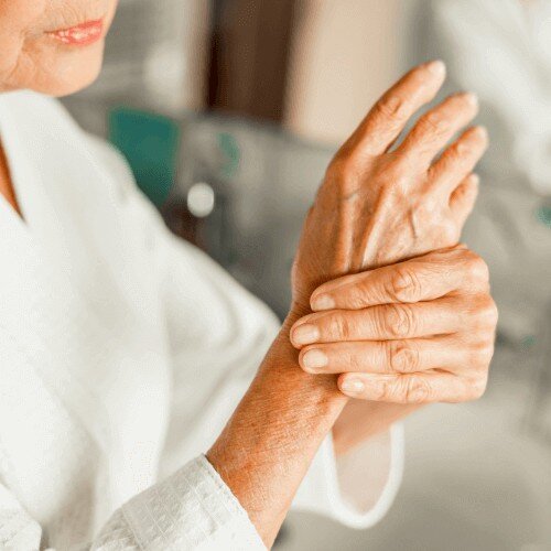 Woman with hyperhidrosis in London holding her own hand.