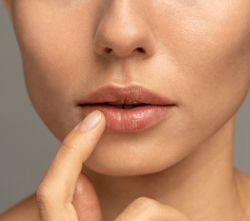 Woman showing her lips after having lip fillers